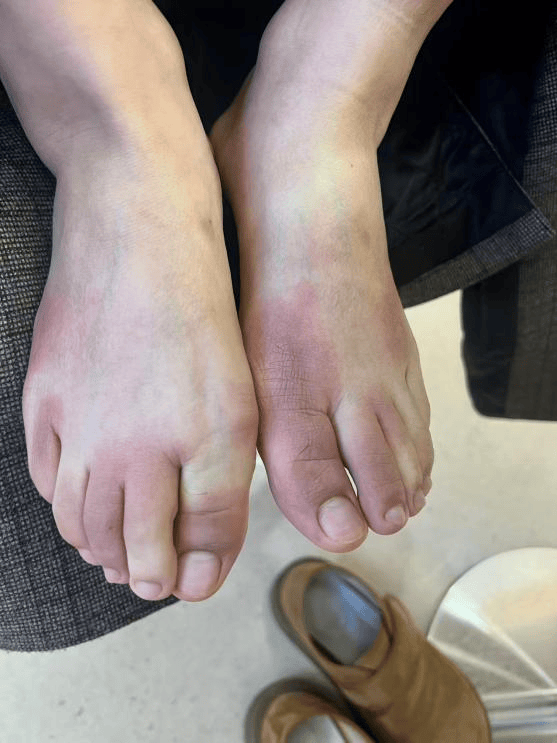 皇冠mos066_东北姑娘来浙江后崩溃了皇冠mos066，穿3条加绒裤还冻到发抖！南方人冬天怎么保命，网友吵翻！