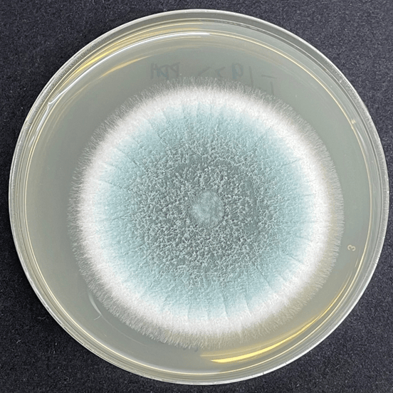 皇冠信用网代理_6岁女童发烧17天皇冠信用网代理，脑子竟被“啃”出十几个洞！“元凶”家中很常见！